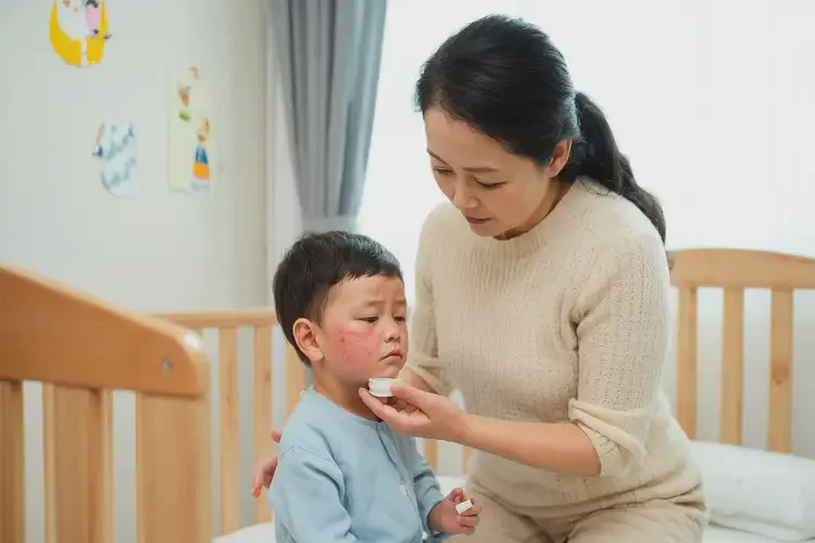幼兒面部出濕疹能徹底自愈嗎(圖2)