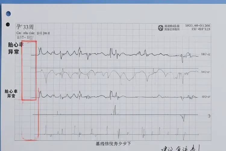 孕33周胎心84正常嗎(圖4)