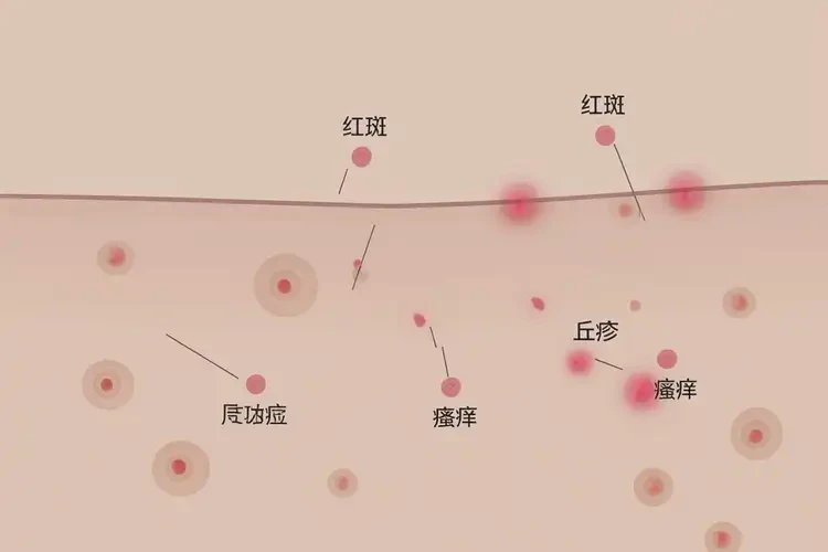 男人肛周出現(xiàn)濕疹不管它會(huì)自己好嗎(圖4)