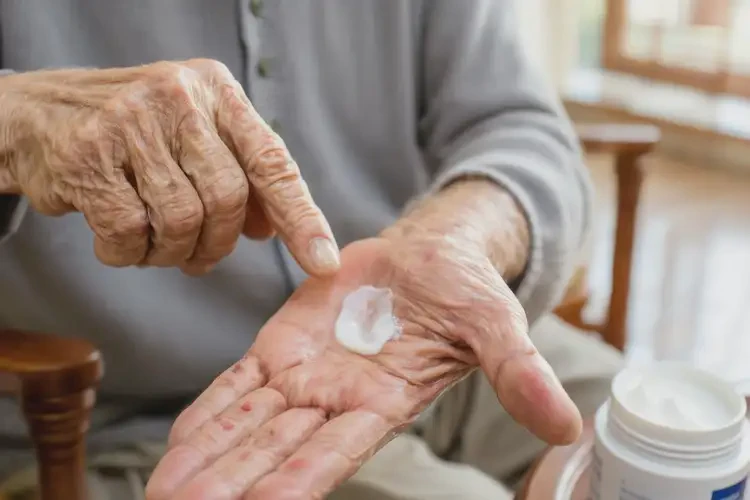 高齡老人手上起濕疹能不能徹底自愈(圖2)