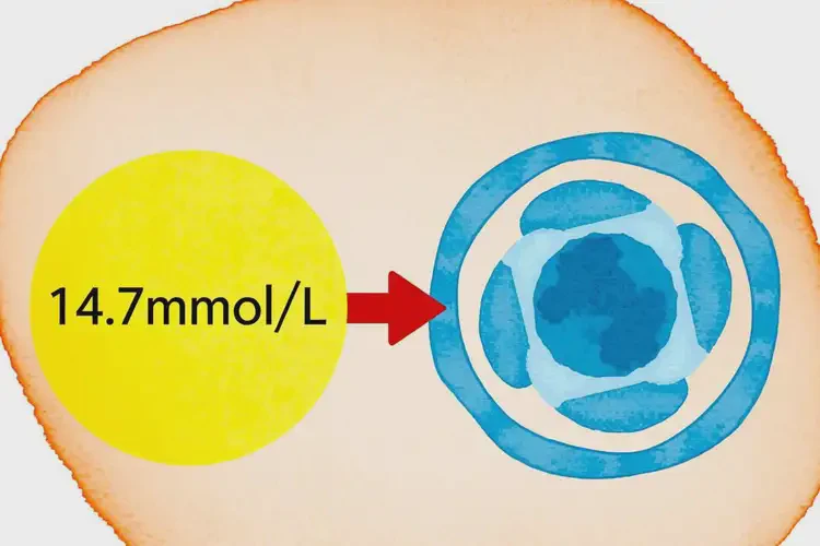 成年人中午血糖14(图1)