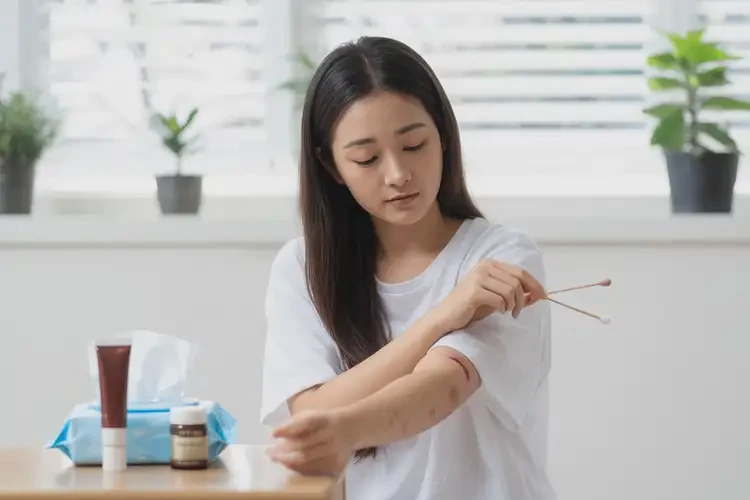 大學(xué)生手臂上偶爾長濕疹不管它會自己痊愈嗎(圖1)