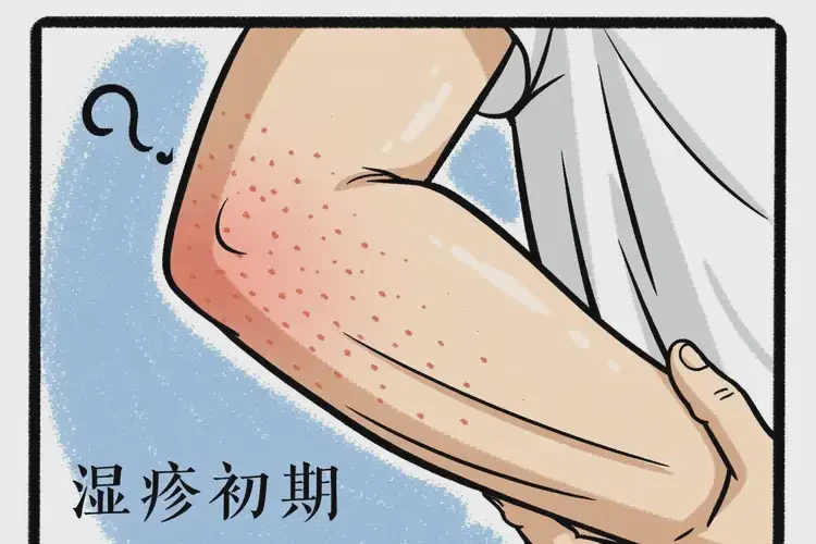 男生手臂起湿疹不管它会自己自愈吗(图3)