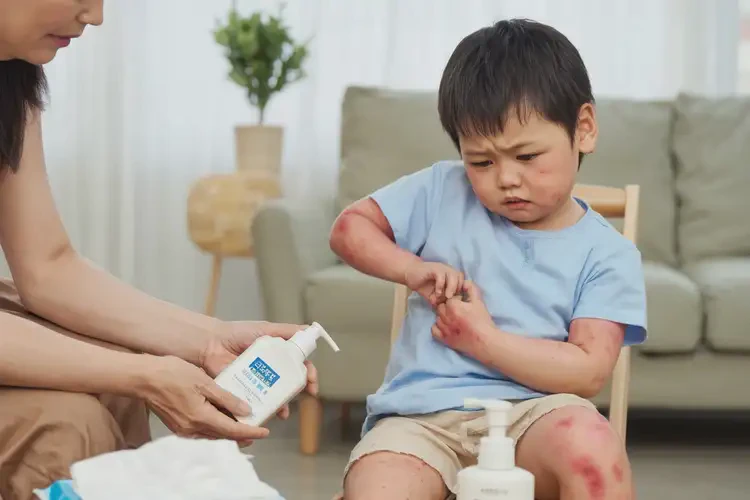少兒屁股偶爾起濕疹能靠自己自愈嗎(圖3)