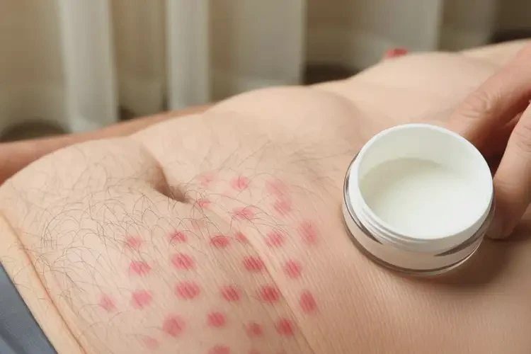 老年人肚子上經(jīng)常起濕疹可以徹底自愈嗎(圖2)