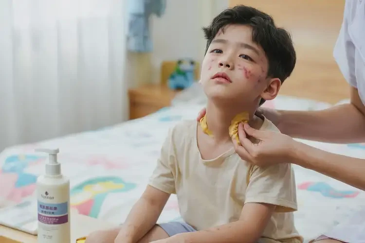 儿童脖子长湿疹可以彻底自愈吗(图3)