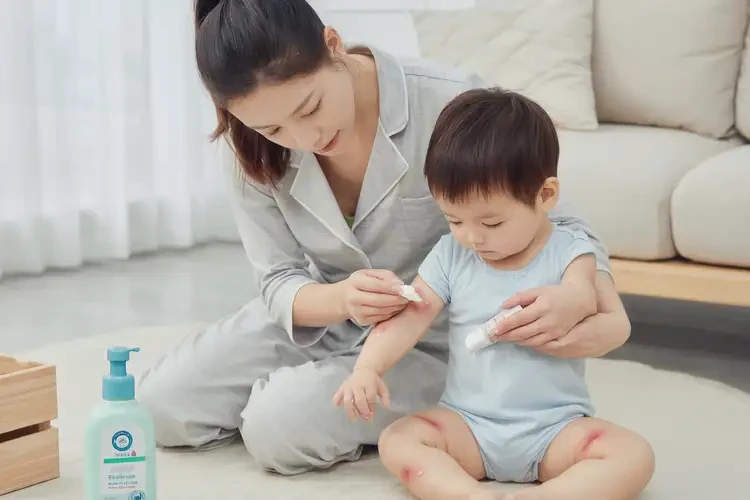 幼兒手上出濕疹不管它會(huì)自己痊愈嗎(圖3)