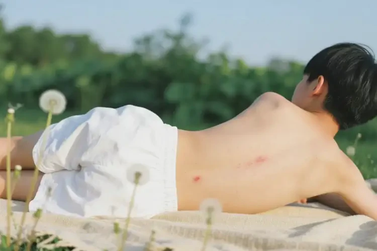 青少年屁股上偶尔起湿疹可不可以彻底自愈(图1)