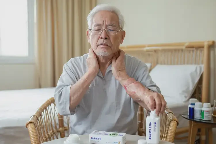 高齡老人脖子出現(xiàn)濕疹能夠徹底治愈嗎(圖4)