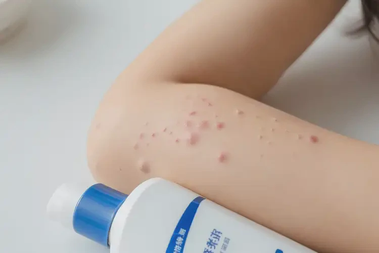 小孩手臂容易起濕疹不管它會自己好嗎(圖4)