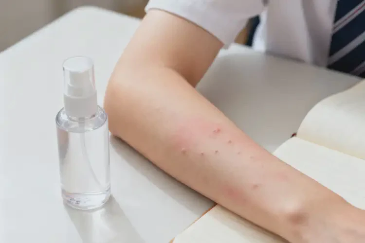 大學生手臂上經常起濕疹能夠徹底治愈嗎(圖2)