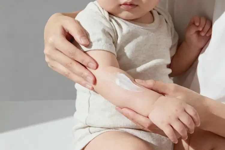 嬰兒四肢出濕疹不管它會(huì)自己痊愈嗎(圖3)