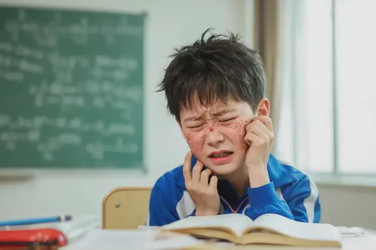 小學(xué)生面部容易起濕疹可以徹底自愈嗎(圖4)