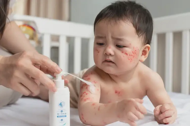 婴幼儿身上长湿疹不管它会自己自愈吗(图4)