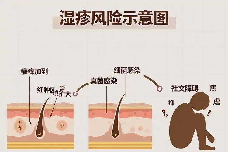 女人面部偶爾長(zhǎng)濕疹不管它會(huì)自己好嗎(圖3)