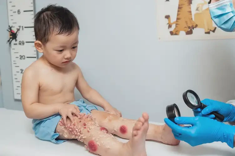 幼兒大腿上容易起濕疹不管它會自己痊愈嗎(圖4)