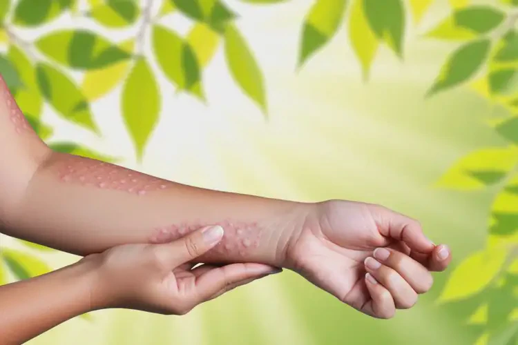 女人手臂偶尔长湿疹不管它会自己自愈吗(图3)