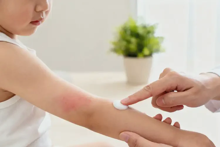 幼兒手臂上容易長(zhǎng)濕疹能夠徹底治愈嗎(圖3)