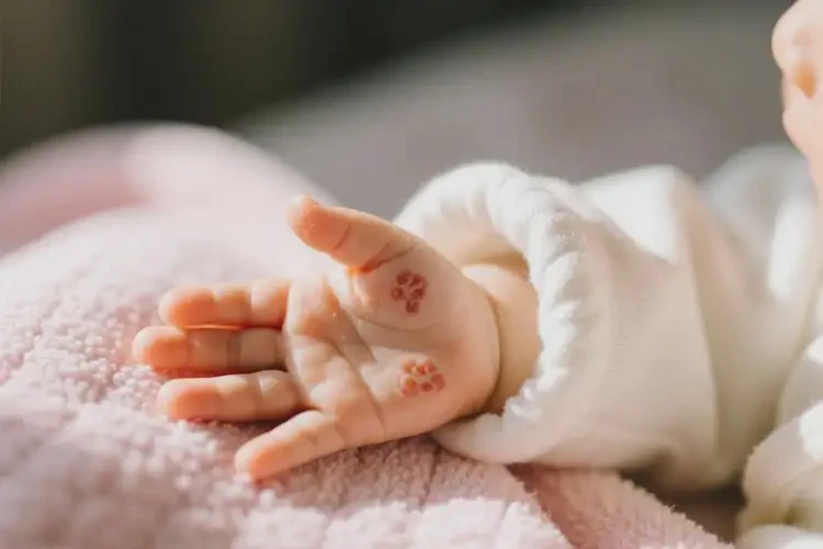 幼儿手上经常长湿疹能够彻底治愈吗(图3)