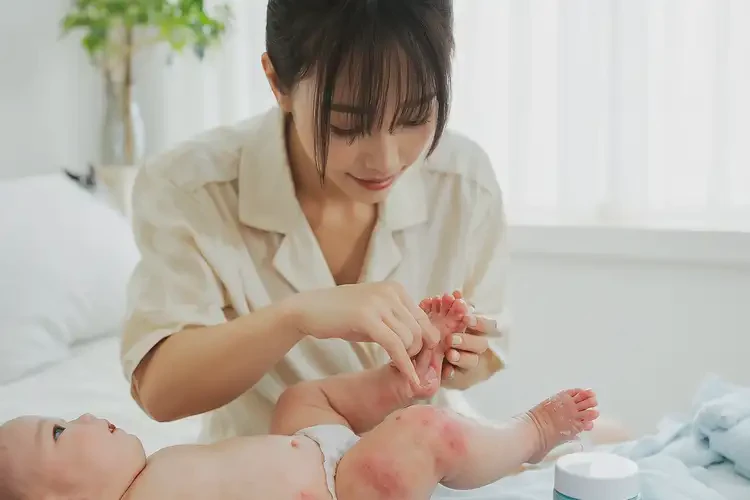 新生儿脚上容易起湿疹能靠自己自愈吗(图3)