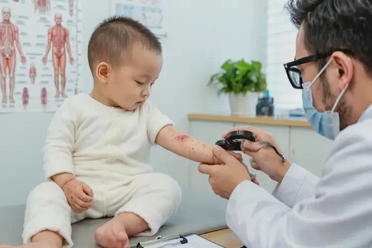 幼兒全身經(jīng)常起濕疹可不可以徹底自愈(圖1)