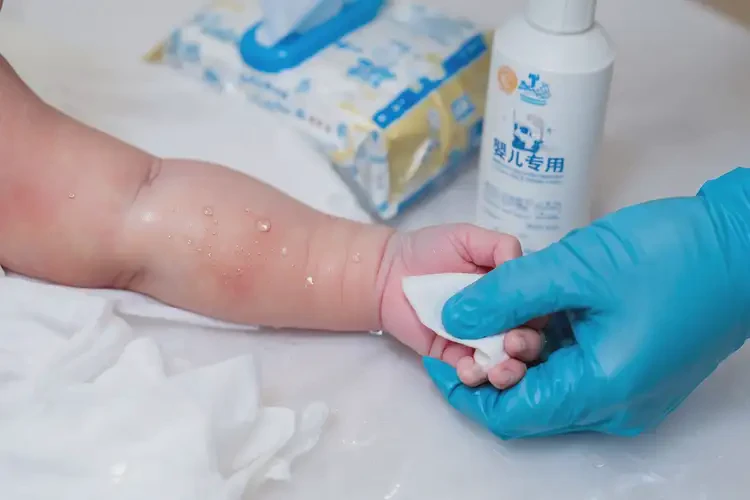 新生兒手臂上容易起濕疹可不可以徹底自愈(圖3)