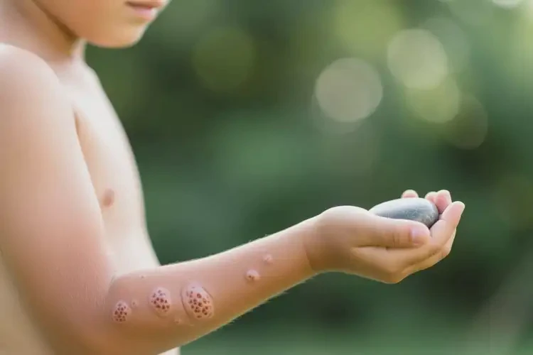 男生手臂经常起湿疹能够彻底治愈吗(图1)