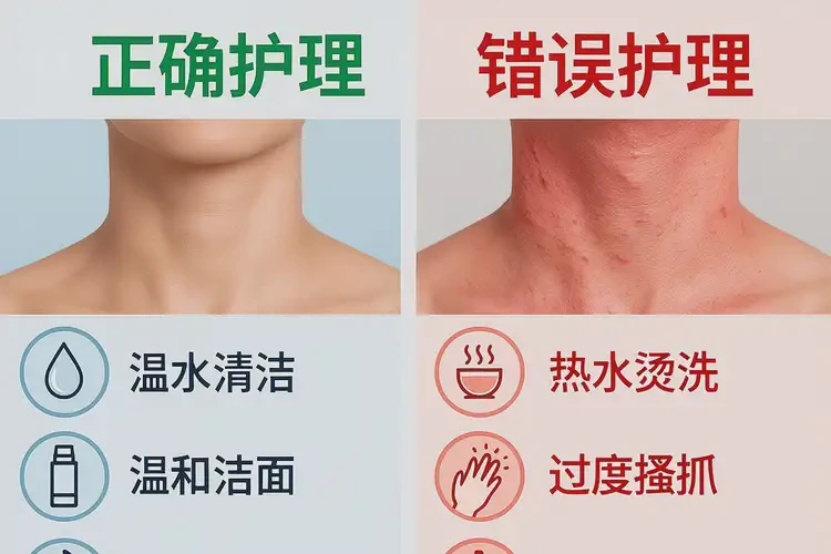 男生脖子出濕疹能靠自己自愈嗎(圖2)