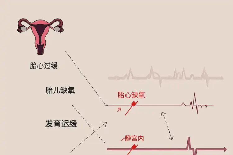 孕31周5天胎心80左右有危险吗(图2)