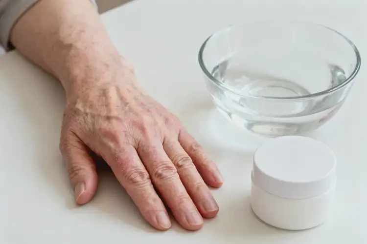 老年人手上偶爾起濕疹能徹底自愈嗎(圖3)