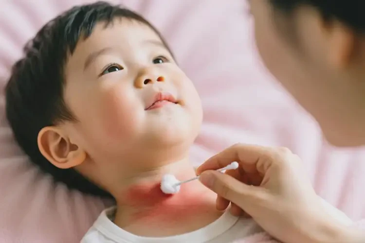 孩子脖子出濕疹可以徹底自愈嗎(圖2)