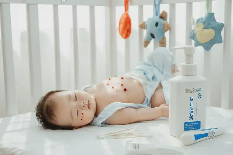 嬰幼兒肚子長(zhǎng)濕疹能靠自己自愈嗎(圖4)
