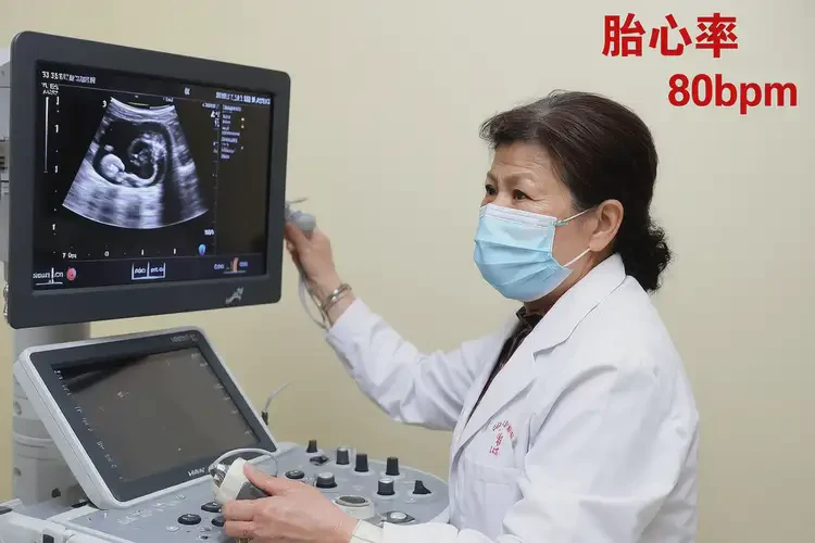孕33周1天胎心率80左右有危險(xiǎn)嗎(圖4)