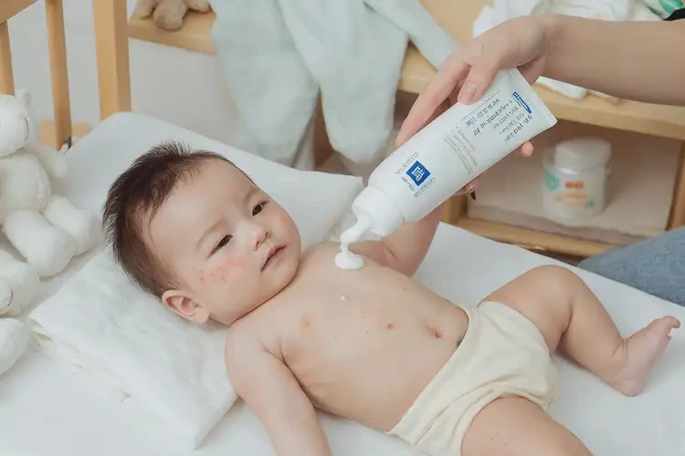 孩子肚子容易起濕疹能徹底自愈嗎(圖4)