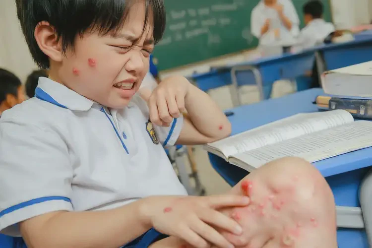 小學(xué)生大腿上偶爾長濕疹不管它會(huì)自己痊愈嗎(圖4)