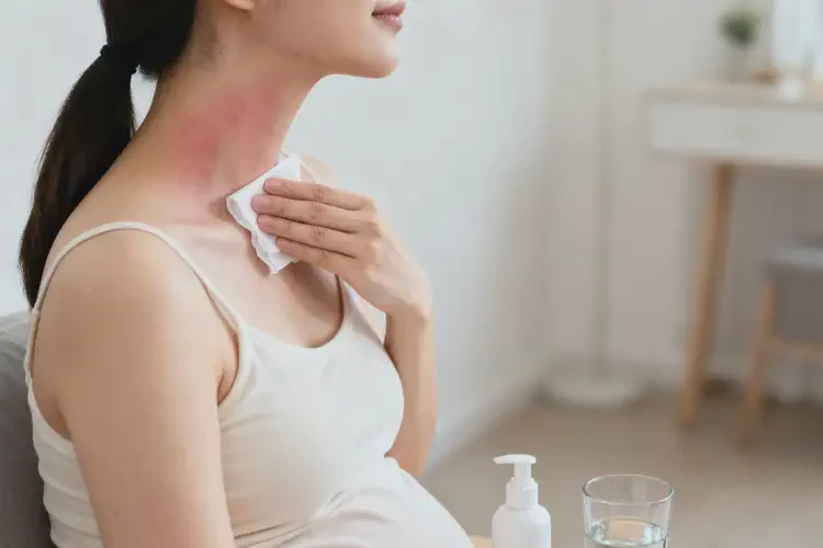 產(chǎn)婦脖子有濕疹能夠徹底治愈嗎(圖2)