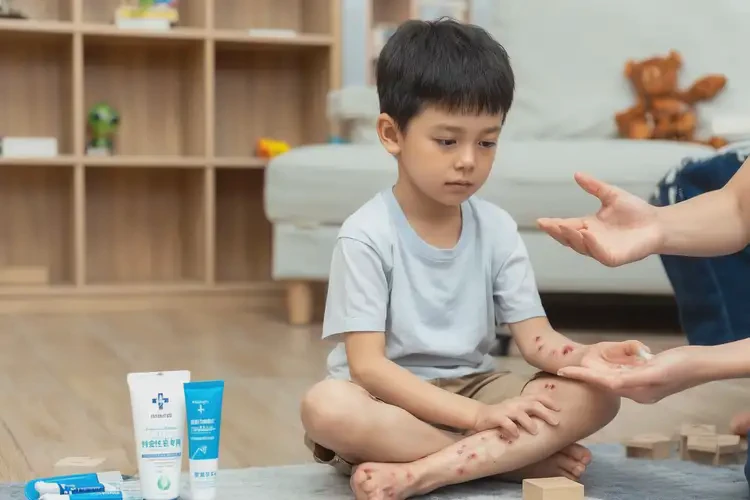 兒童手上起濕疹可不可以徹底自愈(圖3)