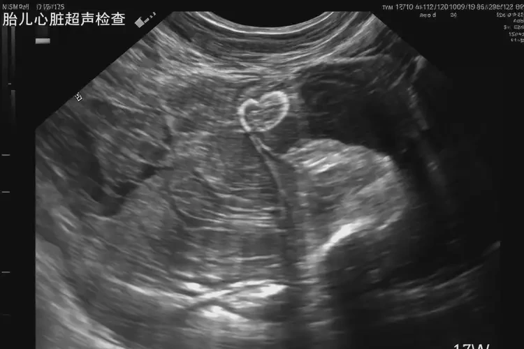 懷孕11周胎心80怎么回事(圖4)