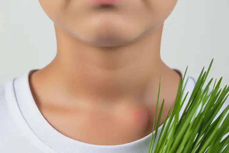 中學(xué)生脖子經(jīng)常長濕疹可不可以徹底自愈(圖3)