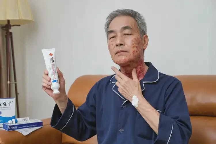 老人脖子上出濕疹不管它會自己痊愈嗎(圖3)