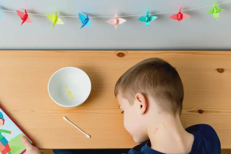 小學(xué)生脖子偶爾起濕疹能不能徹底自愈(圖2)