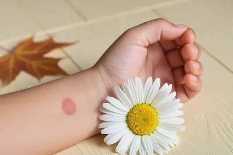 儿童手臂上容易起湿疹能彻底自愈吗(图3)