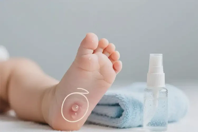 嬰幼兒腳上出濕疹可不可以徹底自愈(圖1)