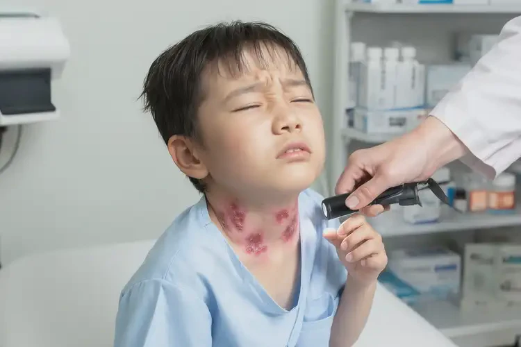 小孩脖子上經(jīng)常長濕疹可以徹底自愈嗎(圖4)