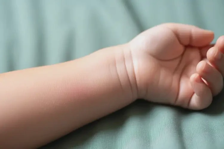 幼儿手臂上偶尔起湿疹能靠自己自愈吗(图1)