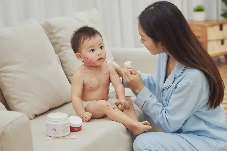 嬰幼兒脖子上有濕疹不管它會(huì)自己自愈嗎(圖3)