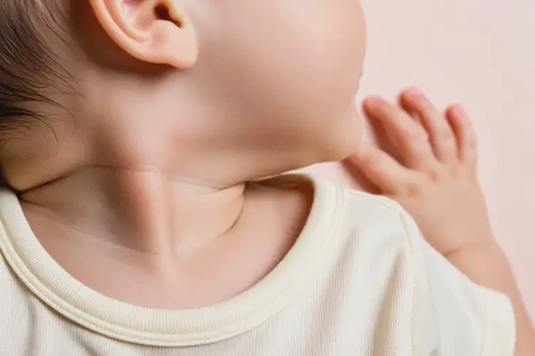 婴儿脖子出湿疹不管它会自己好吗(图1)