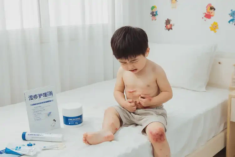 孩子肚子經(jīng)常起濕疹不管它會(huì)自己好嗎(圖2)