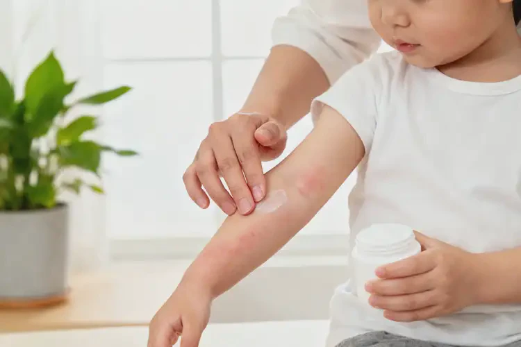 幼兒手臂上容易長(zhǎng)濕疹能夠徹底治愈嗎(圖2)