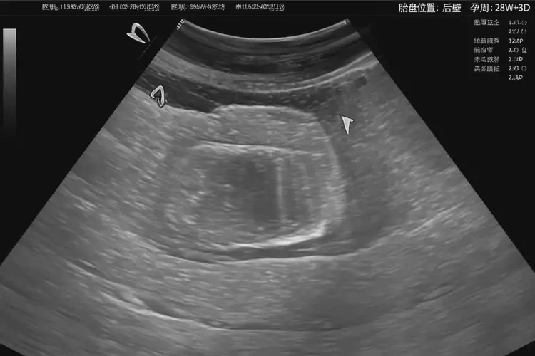 懷孕11周胎心80怎么回事(圖3)